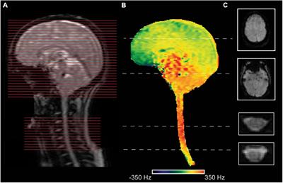 Recent developments and future avenues for human corticospinal neuroimaging